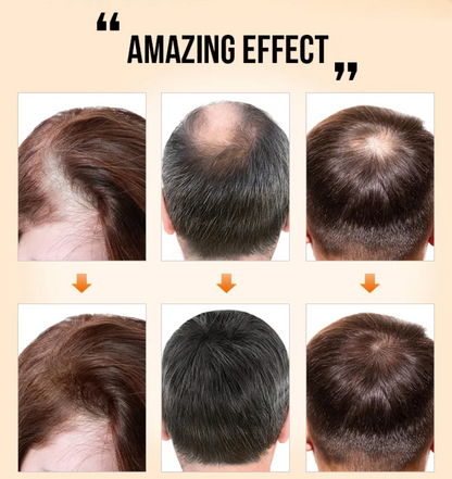 The Cozlit Hair Growth Serum